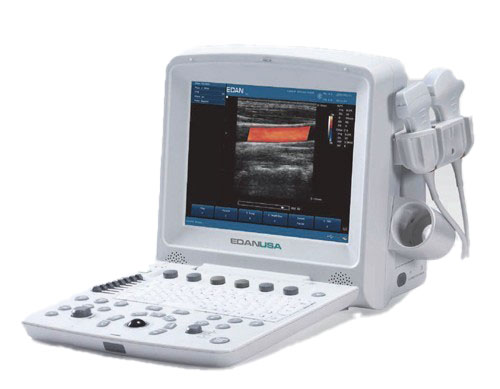 Edan Ultrasound U50 PRIME.jpg